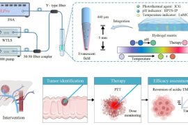 sonda a fibra ottica cura del tumore