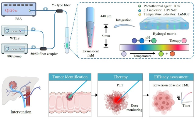 sonda a fibra ottica cura del tumore