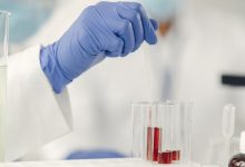 Fentanyl test