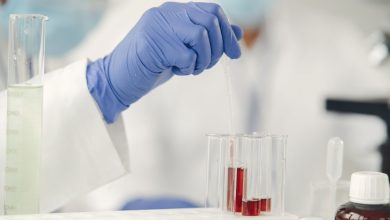 Fentanyl test